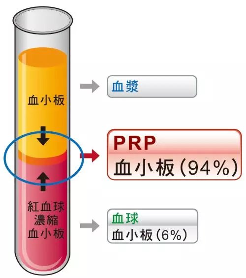 PRP技术治疗骨病培训班（12月北京）PRP治骨病技术学习班